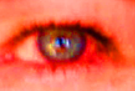 Auge 1